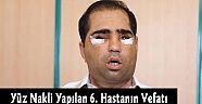 Yüz Nakli Yapılan 6. Hastanın Vefatı